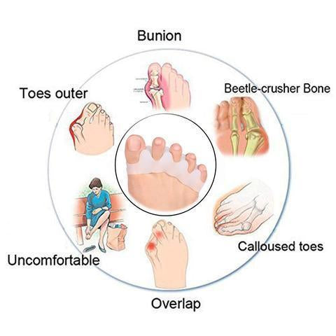 Orthopedic Hammer Toe Corrector (BUY 1 GET 1)